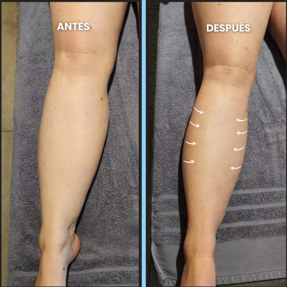 Gotas de Bienestar para Drenaje Linfático | Vitalora DrenaDrops™