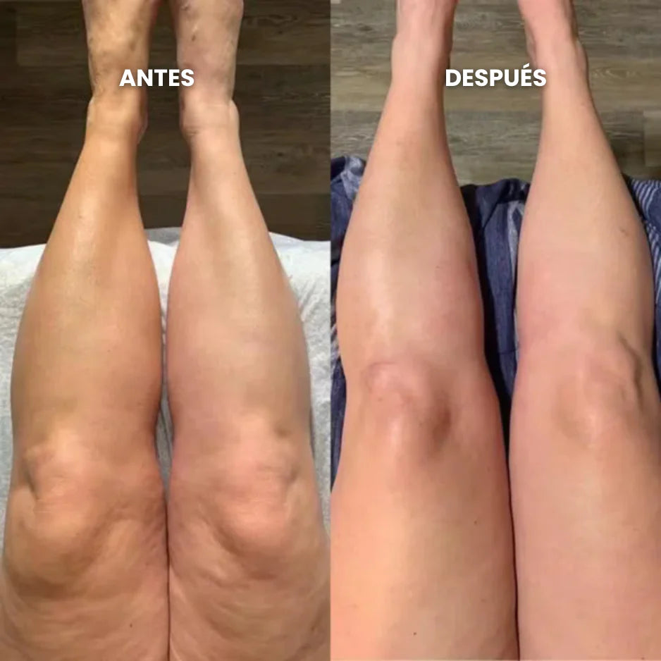 Gotas de Bienestar para Drenaje Linfático | Vitalora DrenaDrops™